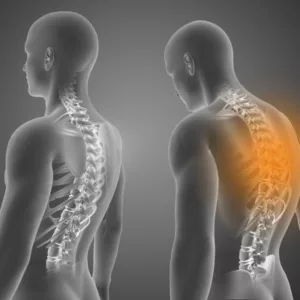 Chiropractic spinal adjustments can help improve posture
