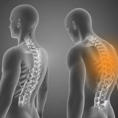 Chiropractic spinal adjustments can help improve posture 