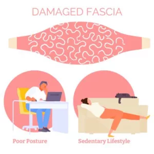 Myofascial release can help ease damaged fascia. Which can happen when you are sedentary, maintain poor posture, or have inflammation or injury