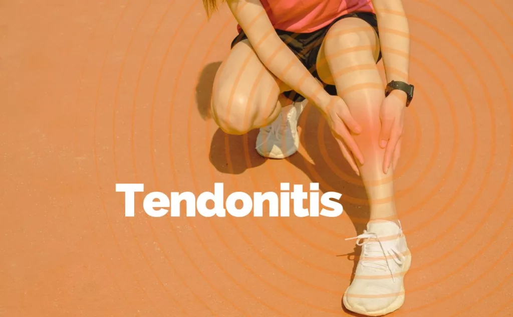 Chiropractic and other therapies can be help treat tendonitis