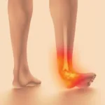 Outward rolling ankle with red spot signifying an eversion sprain.