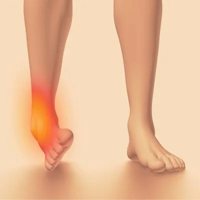 Inward rolling ankle with a highlighted red spot indicating sprain injury.