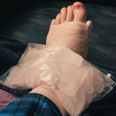 Ankle sprain treatment with ice pack, elevation, and compression bandage.
