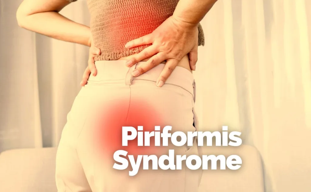 Piriformis Syndrome can cause pain in the lower back and buttocks