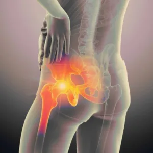 Man holding his hip in pain with an X-ray view showing the internal bones of the hip and a red glow indicating radiating pain.